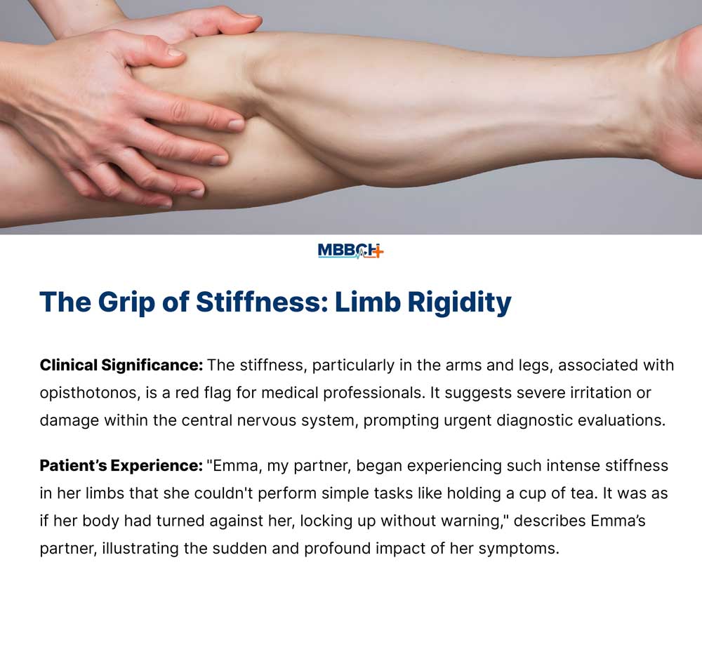 The-Grip-of-Stiffness-Limb-Rigidity